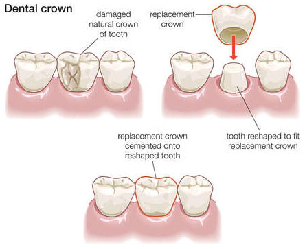 Crown San Antonio