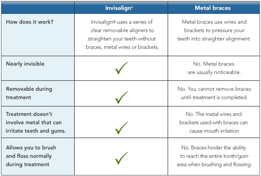 Invisalign vs Metal Bracess